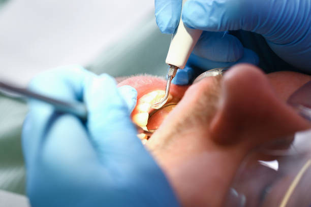 Best Pediatric Emergency Dentist in Buckhead Ridge, FL
