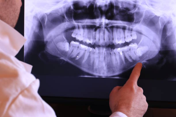 Best Walk-In Emergency Dentist in Buckhead Ridge, FL