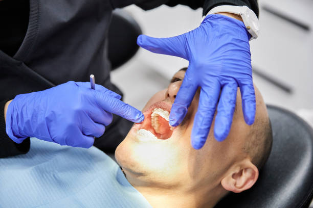 Best Emergency Wisdom Teeth Removal in Buckhead Ridge, FL