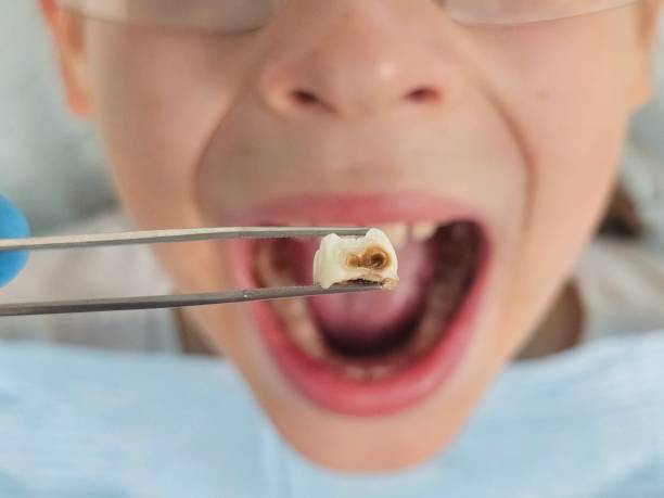 Best After-Hours Emergency Dentist in Buckhead Ridge, FL